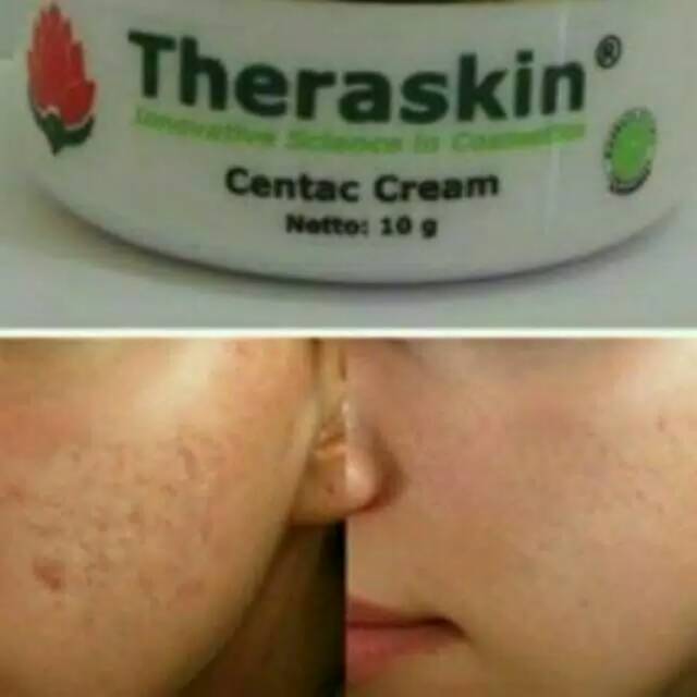 Centac cream -  theraskin centac cream