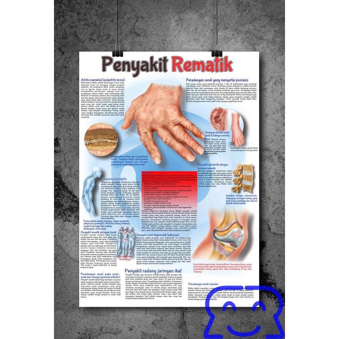 

Poster Rematik – Apa itu Arthritis Rheumatoid dan Gejalanya