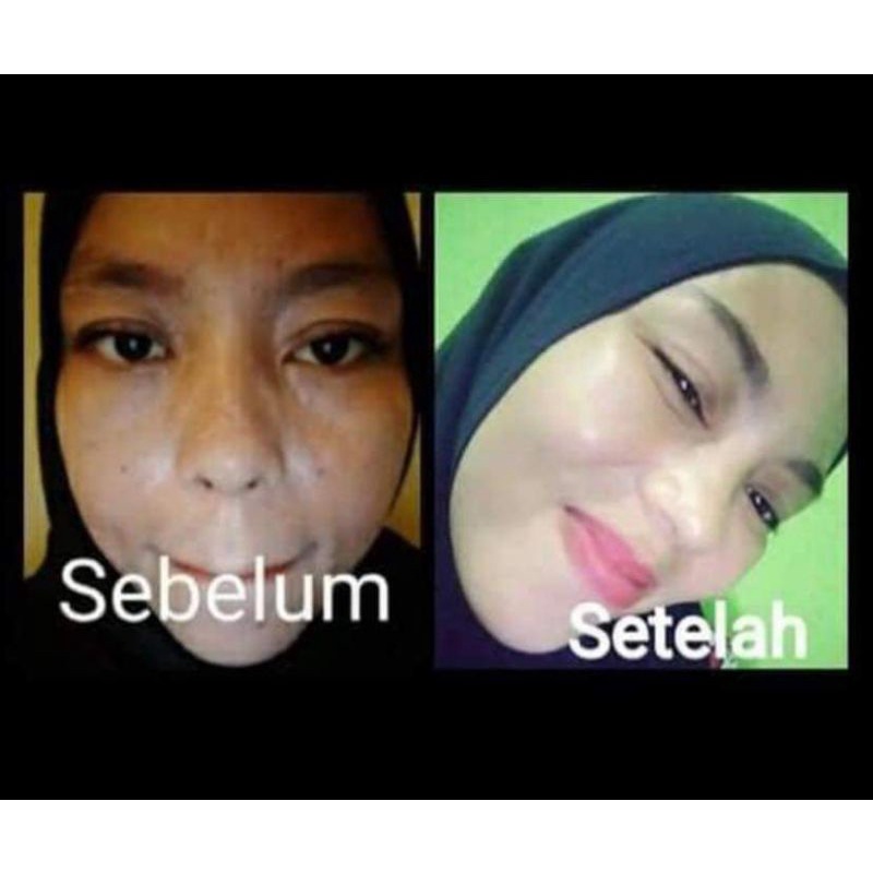MH Whitening Skin