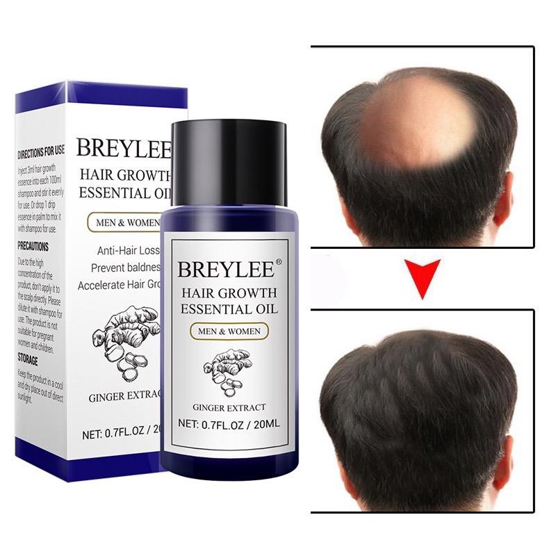 Breylee Minyak Esens Penumbuh Rambut Cepat 20mL HAIR GROWTH ESSENTIAL OIL Breylee Minyak Esens Penumbuh Rambut Cepat 20mL HAIR GROWTH ESSENTIAL OIL BE-04