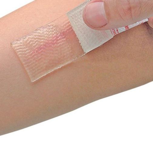 ➲ Cica-Care Silicone Gel untuk Keloid ✾