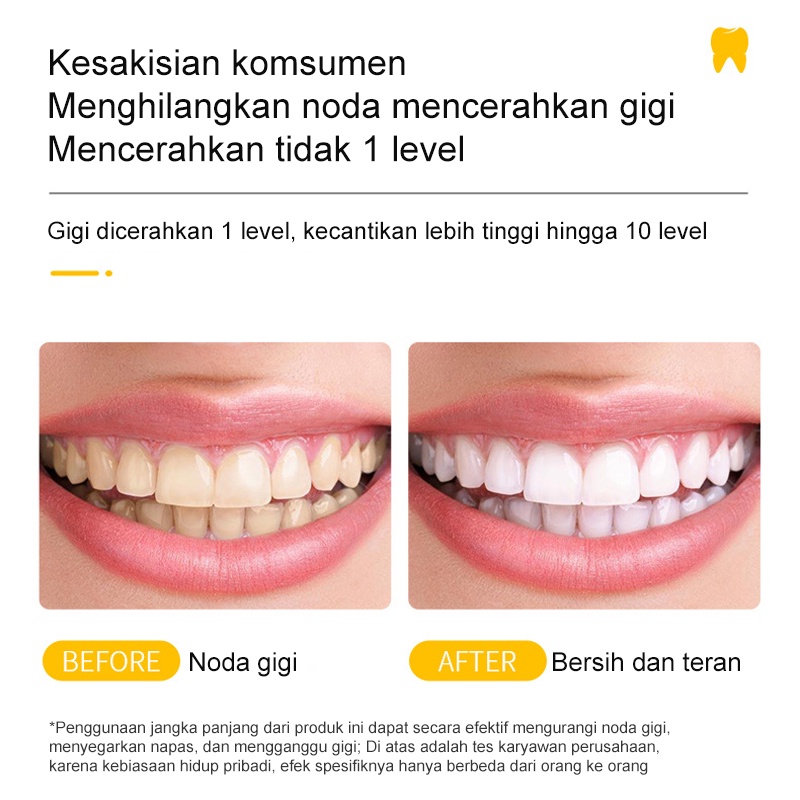 Teeth Whitening Toothpaste Pasta Gigi pemutihan gigi 180g penghilang plak Gigi Memutihkan Gigi Antibakteri Cegah kerusakan gigi anak bisa menggunakan