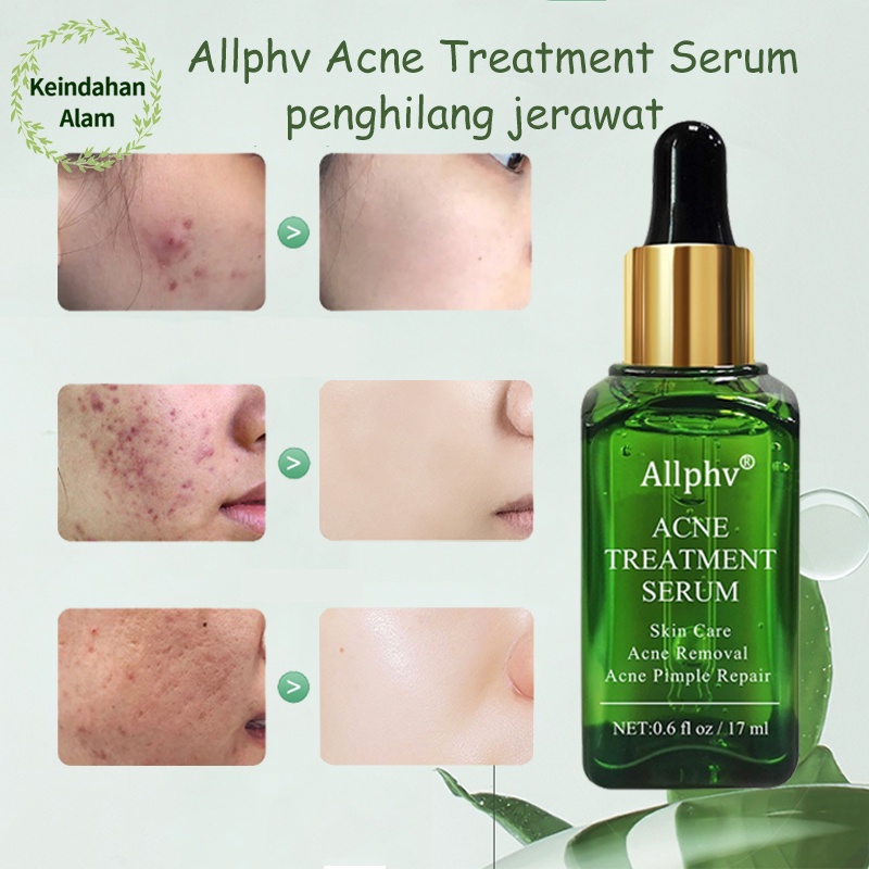 Allphv Acne Serum Anti Acne Serum Acne Spot Treatment  Acne Serum Anti Jerawat Acne Patch