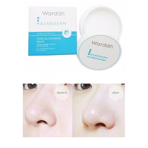 Wardah acnederm pore blackhead balm 20gr