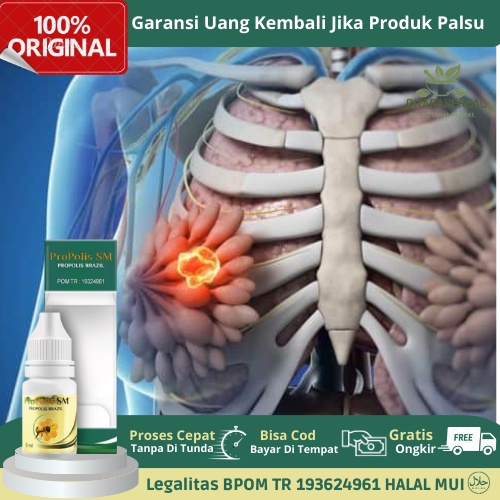 Obat Benjolan Payudara, Obat Tetes Benjolan Payudara, Obat Nyeri Benjolan Payudara, Obat Penghilang 