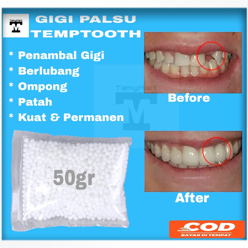 GROSIR temptooth penambal gigi isi 50 gr asli super kuat