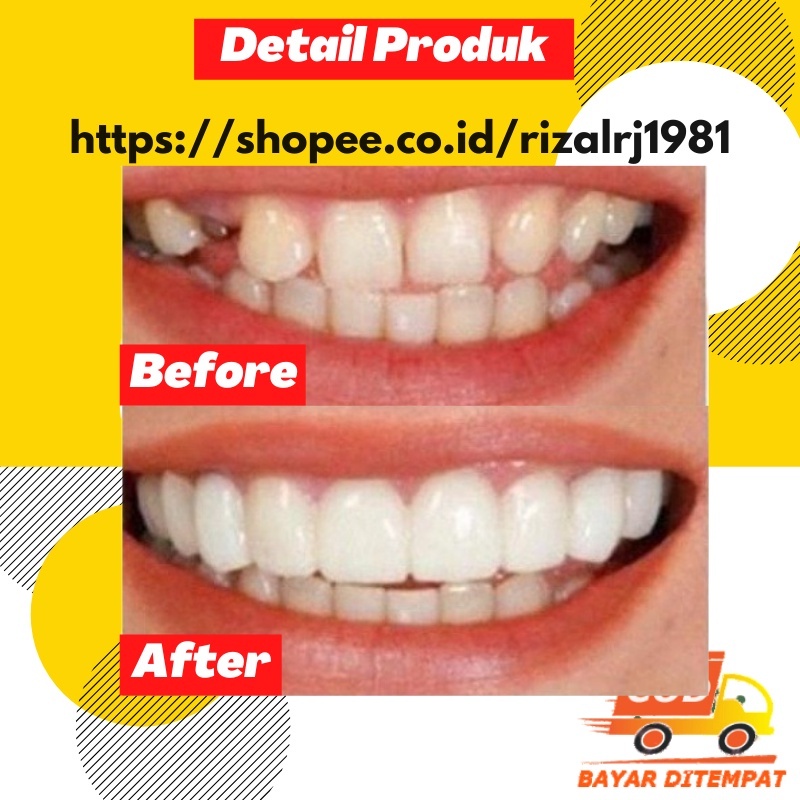 PALING DICARI Gigi Palsu Atas Bawah Snap On Smile Gigi Palsu Instan Silikon Snap On Smile Putih Auth