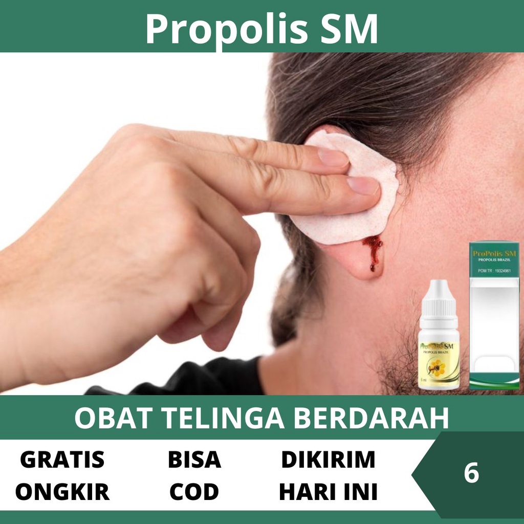 Obat Telinga Berdarah - Obat Tetes Pengering Telinga Luka Berdarah Dan Bernanah, Penghilang Sakit Lu