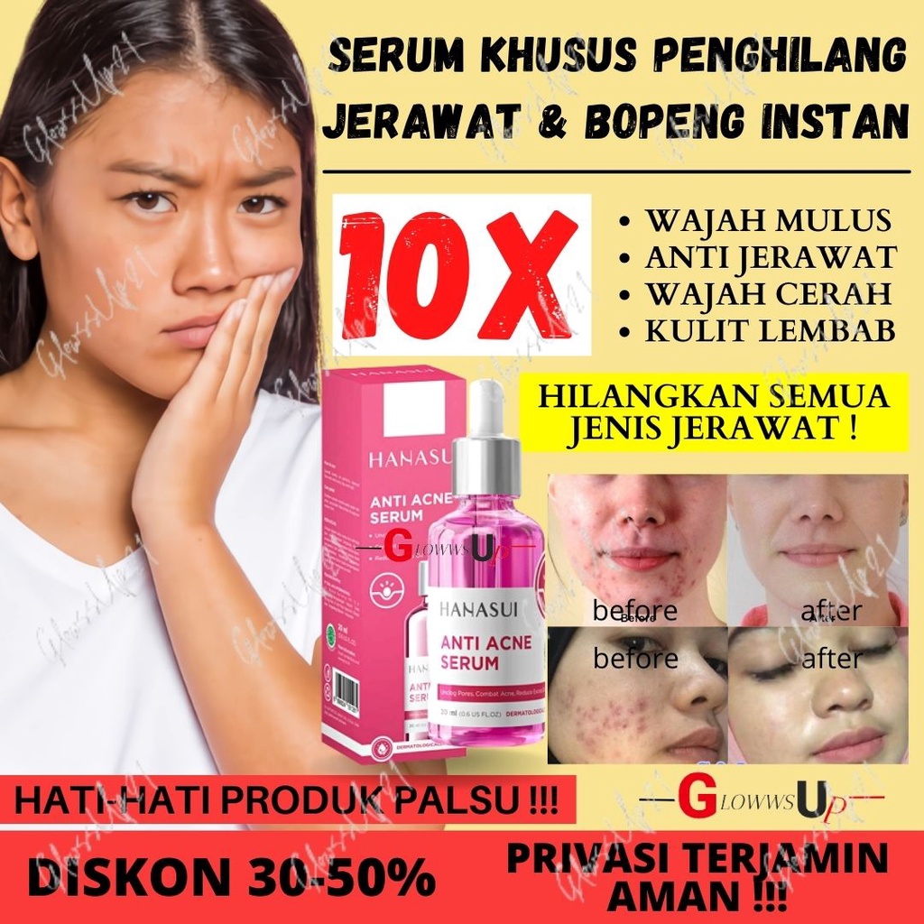 SERUM HANASUI ANTI ACNE (PINK) - SERUM WAJAH HANASUI JAYA MANDIRI