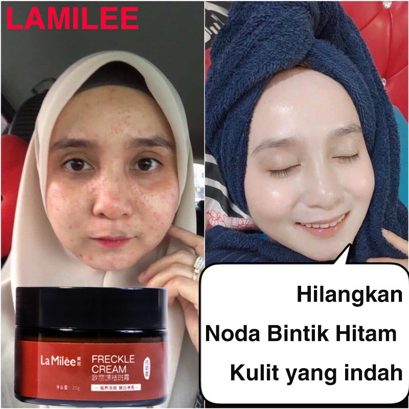 La Milee Krim Bintik Cream Penghilang Flek Hitam Salep Melasma Flek Hitam Ampuh Efektif Krim Penghilang Bintik-bintik 30Gr Hight Whitening Freckles Cream