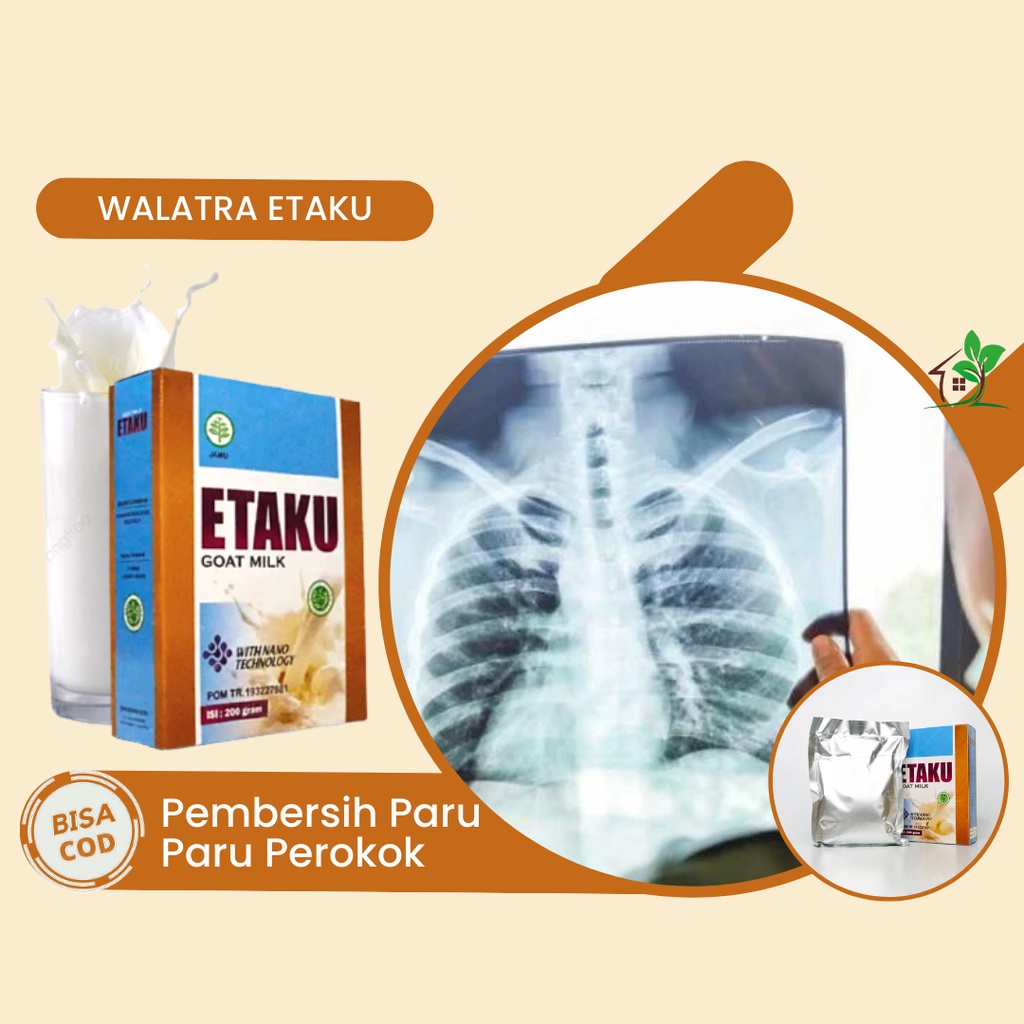 

Susu Pembersih Paru Paru, Pembersih Paru-Paru Perokok, Pembersih Paru Kotor, Obat Sakit Paru Paru, Obat Flek Paru Paru, Obat Infeksi Paru Paru, Obat Asma, Obat Nyeri Dada, Obat Sesak Nafas, Obat TBC Paru, Obat Masalah Pernapasan dengan Susu Etaku