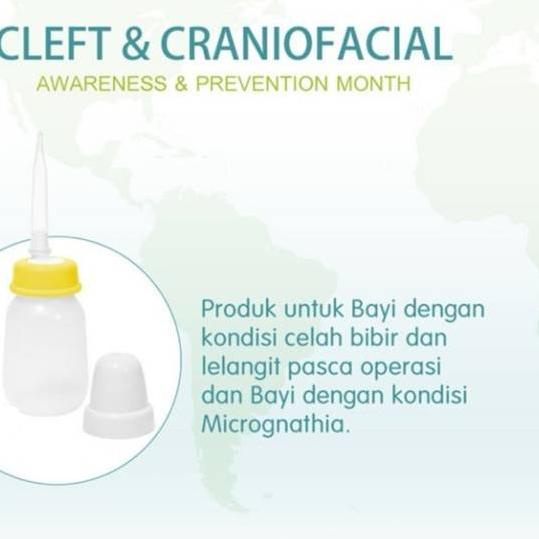 ⅎ Botol Bibir Sumbing Pigeon Botol Pipet Bibir Sumbing Pigeon dot panjang bayi ➧