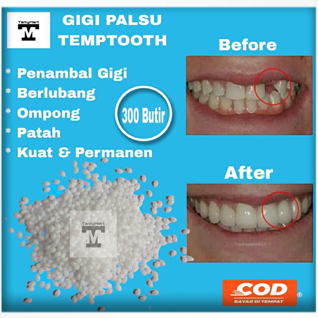 DIKIRIM HARI INI penambal gigi isi 300 butir temptooth kuat asli