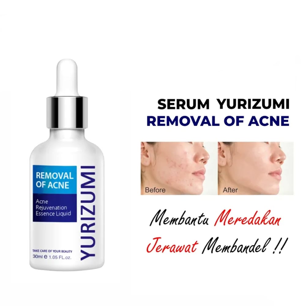 Beauty Jaya - Yurizumi Pure Skin Serum Skin Care Glowing Serum Wajah Anti Jerawat