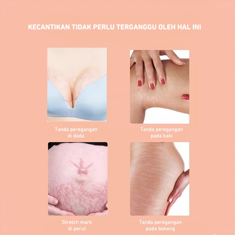 Stretch Mark Selulit Oil Penghilang Pemudar Stretch Mark/ Bio Oil / Penghilang Bekas Luka/ Strech Mark/ Penghilang Strech Mark/ Dry Skin Care