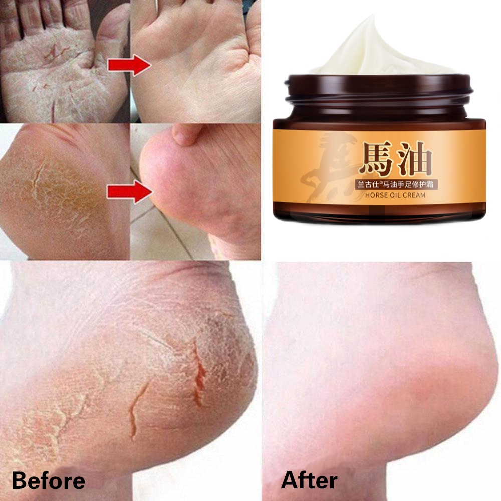 Krim kaki tangan Krim kaki pecah pecah Pemutih tangan dan kaki Minyak kuda tangan dan kaki retak Tumit kering dan pecah-pecah Tumit pecah-pecah Anti-retak Retak dan pecah-pecah Krim penyembuhan perawatan kaki