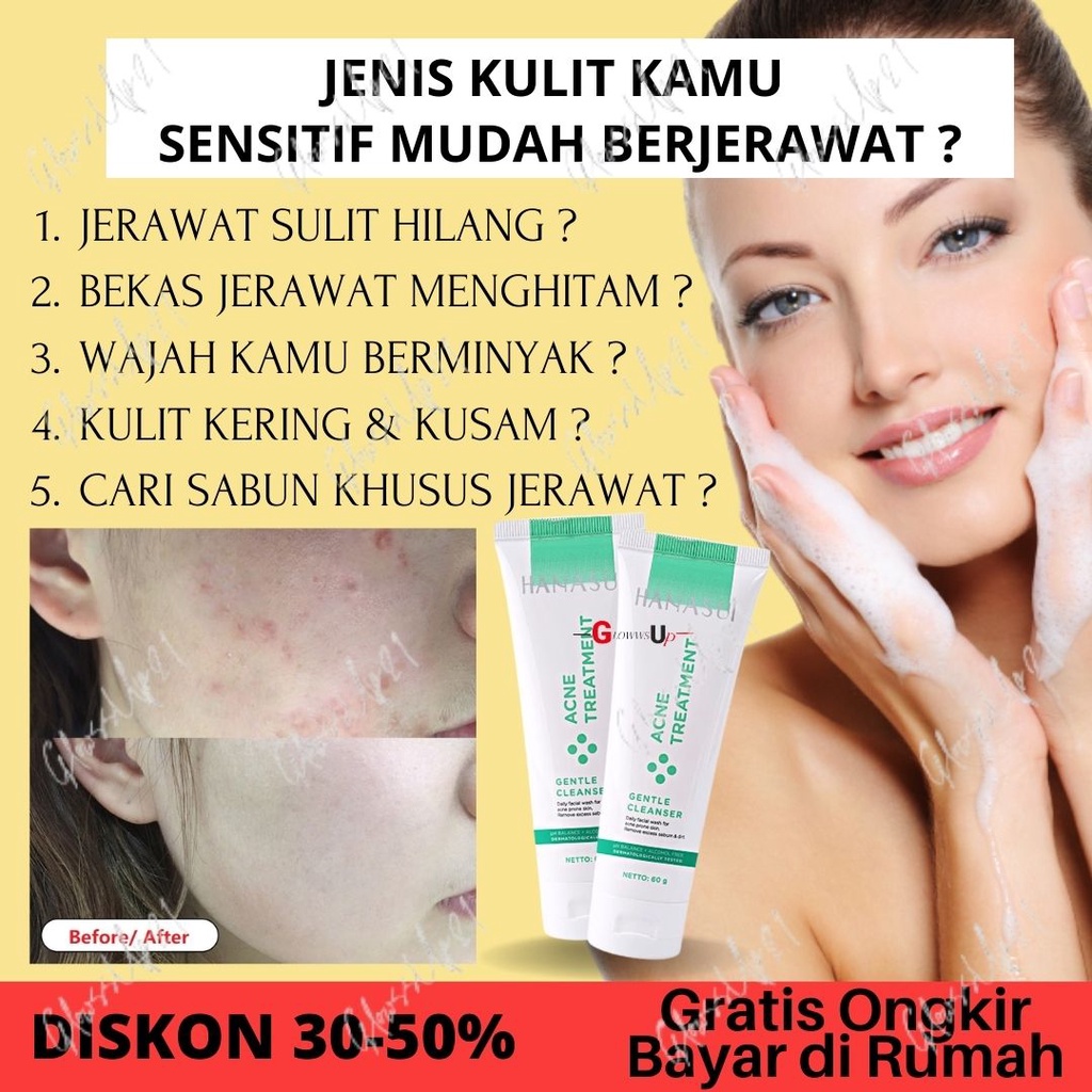 SABUN WAJAH PENGHILANG JERAWAT DAN BEKAS JERAWAT HANASUI ACNE TREATMENT GENTLE CLEANSER 60GR SABUN WAJAH HANASUI ACNE