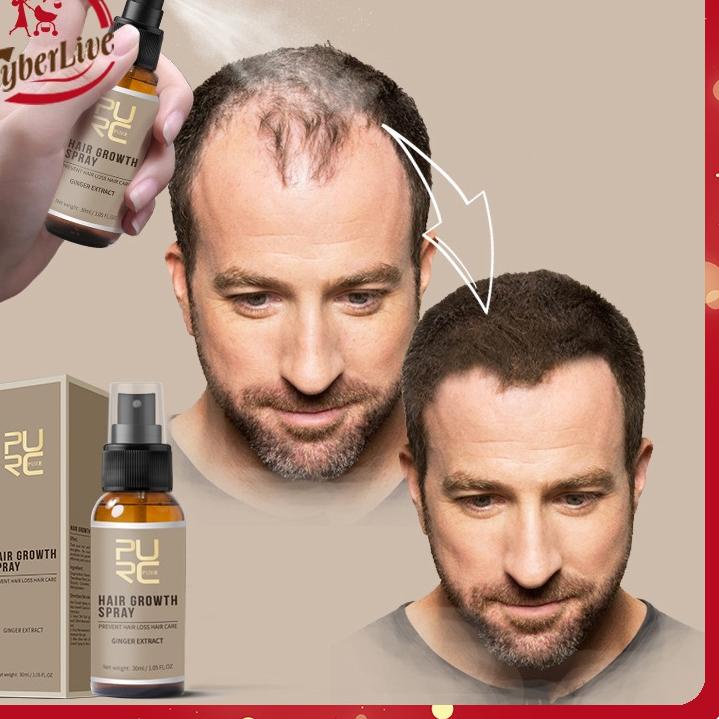 ♧ 20ml Hair Serum Penumbuh Rambut Prevent Hair Loss Hairen Hair Growth Serum Essence Oil ☃