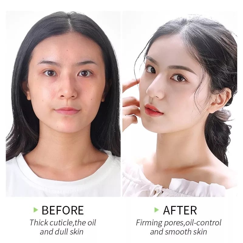 ALOE VERA CENTELLA EXFOLIATING ASIATICA PEELING GEL PERONTOK DAKI/MENGANGKAT SEL SEL KULIT MATI