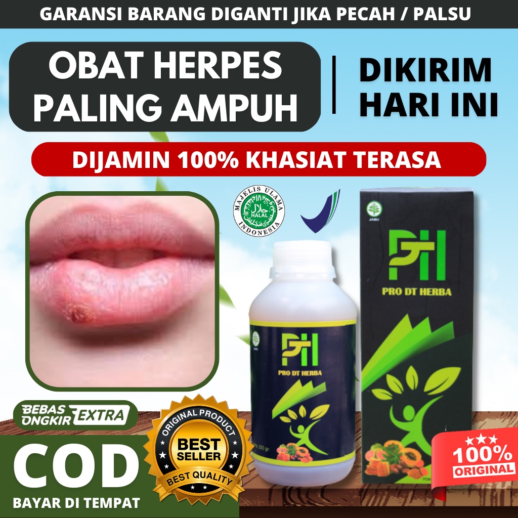 Obat Herpes Kulit Paling Ampuh, Obat Herpes Kelamin, Obat Herpes Zoster, Herpes Genital, Herpes Bibi