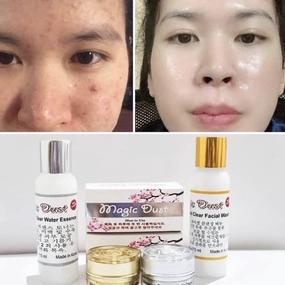 Terkini PAKET WHITENING GLOWING CREAM PERAWATAN WAJAH KRIM MAGIC DUST PLATINUM KOREA MEMUTIHKAN MENC