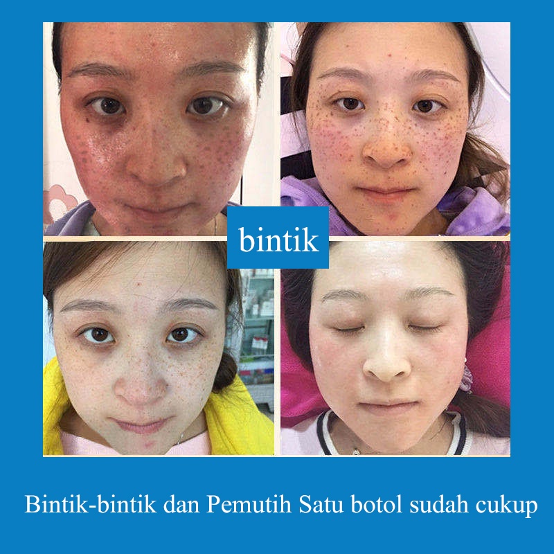 La Milee Krim Bintik Cream Penghilang Flek Hitam Salep Melasma Flek Hitam Ampuh Efektif Krim Penghilang Bintik-bintik 30Gr Hight Whitening Freckles Cream