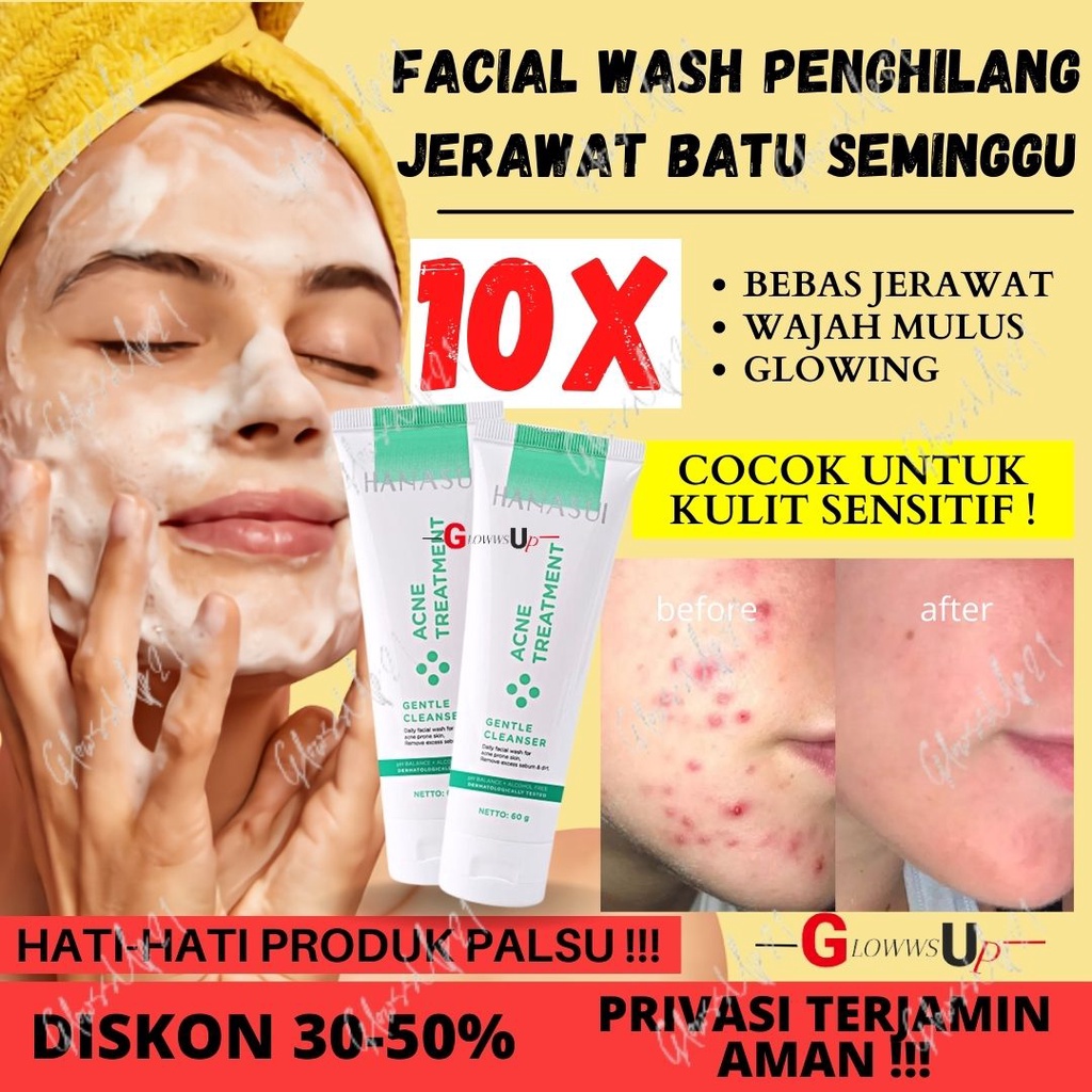 SABUN WAJAH PENGHILANG JERAWAT DAN BEKAS JERAWAT HANASUI ACNE TREATMENT GENTLE CLEANSER 60GR SABUN WAJAH HANASUI ACNE