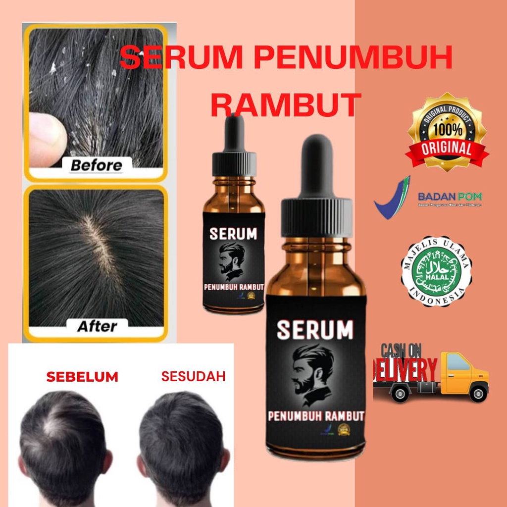 serum penumbuh rambut/serum penumbuh rambut botak/serum penumbuh rambut botak super cepat/serum penumbuh rambut botak Pria Dan Wanita