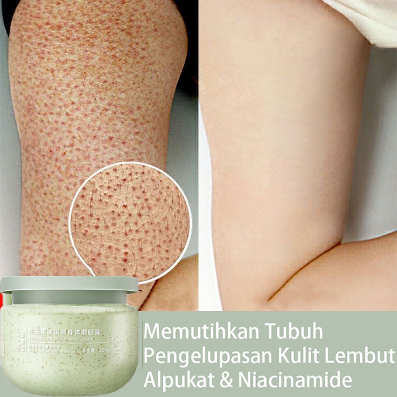 Body Scrub Body Bleaching Whitening Lulur Tubuh 250g Shea Butter Body Lulur Scrub Pemutih Badan dan Menghaluskan Kulit Eksfoliasi aman dan efektif