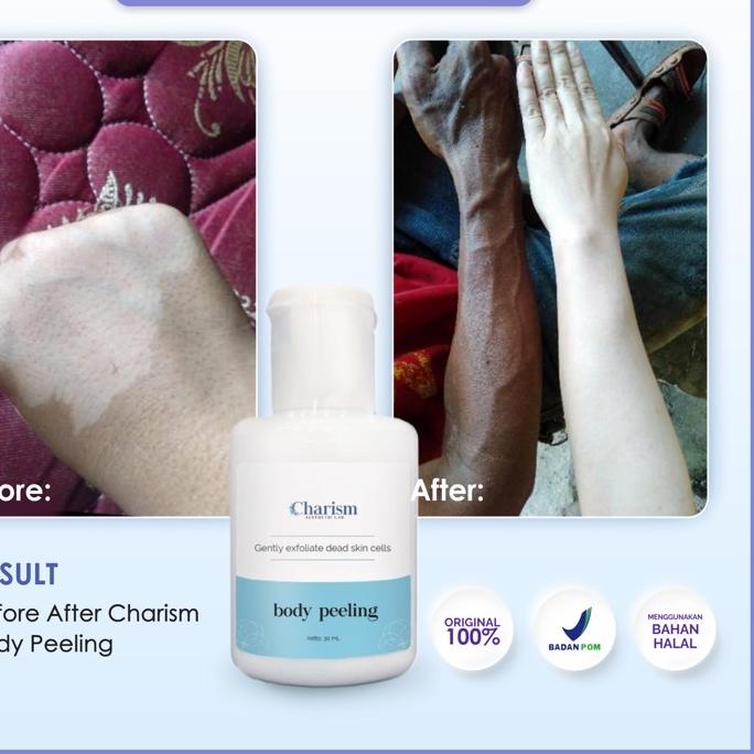 ➵ AHA 10% - BODY PEELING SOLUTION - PENGELUPASAN KULIT BADAN ☋