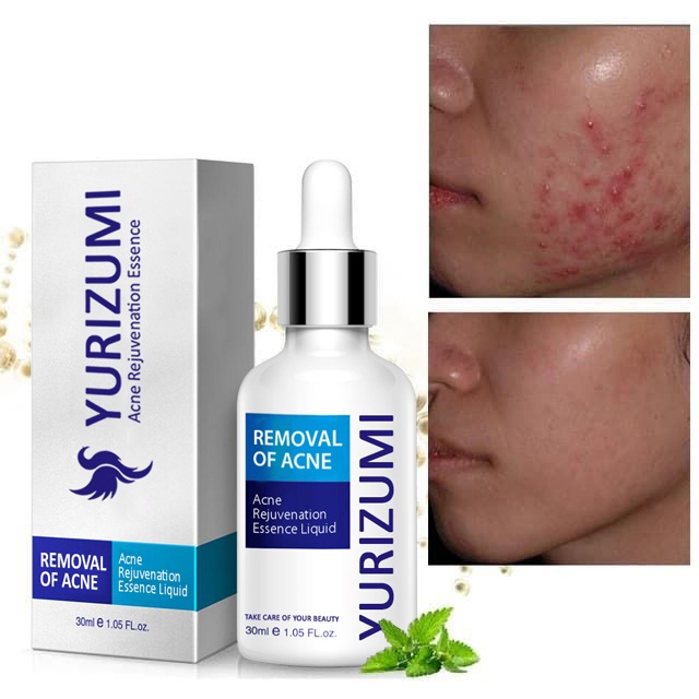 Yurizumi Pure Skin Serum Wajah Anti Jerawat / Menghilangkan Jerawat Bandel /Acne Removal Serum 30ml