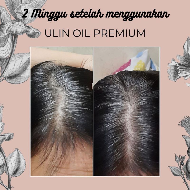 BESS SELLER | Penghitam Rambut Uban Permanen Halal Original Asli Paling Ampuh