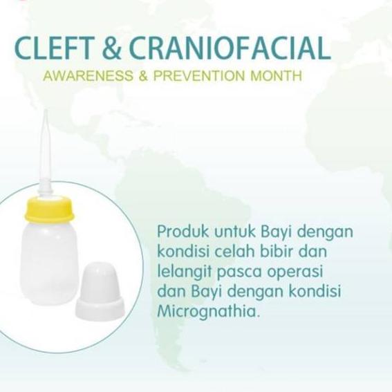 ➲ Botol Bibir Sumbing Pigeon Botol Pipet Bibir Sumbing Pigeon dot panjang bayi ☊