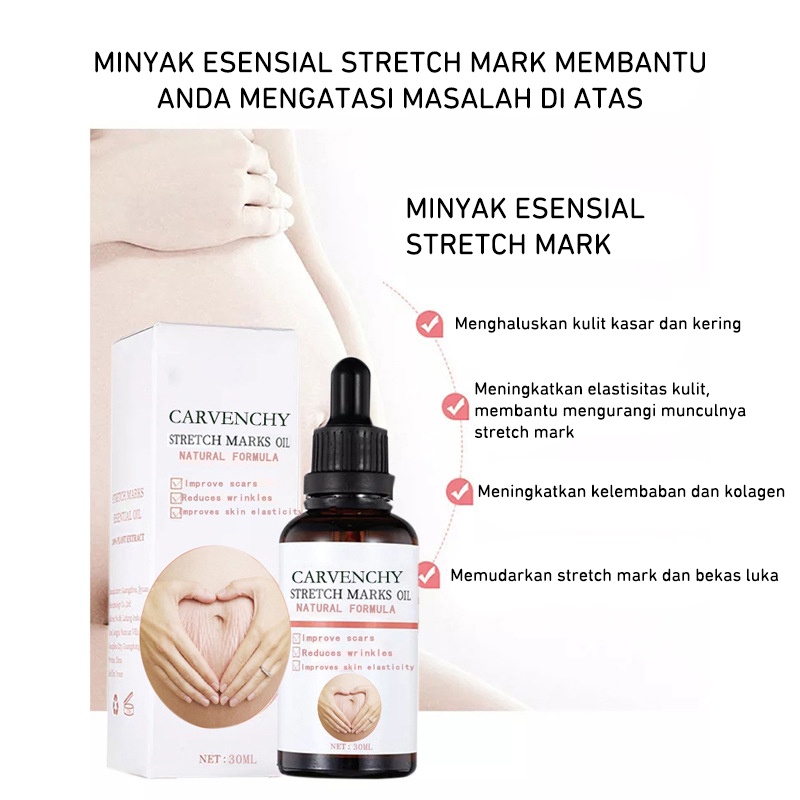 DADAWARD Stretch Mark Selulit Oil Penghilang Pemudar Stretch Mark/ Bio Oil / Penghilang Bekas Luka/ Strech Mark/ Penghilang Strech Mark/ Dry Skin Care