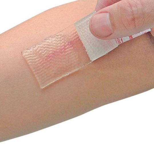 ❂ Cica-Care Silicone Gel untuk Keloid ♂