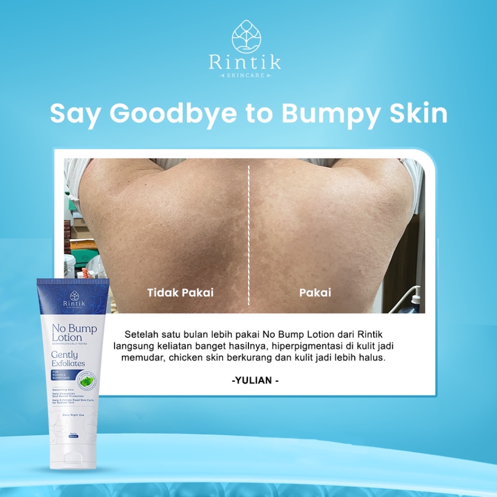 [ FREE GIFT ] Rintik Skincare No Bump Lotion - Lotion Tubuh Kulit Bruntusan Jerawat Punggung