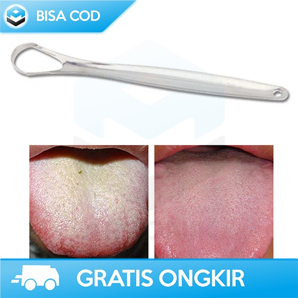 SIKAT PEMBERSIH LIDAH STAINLESS MURAH REUSABLE TONGUE CLEANER LSO134