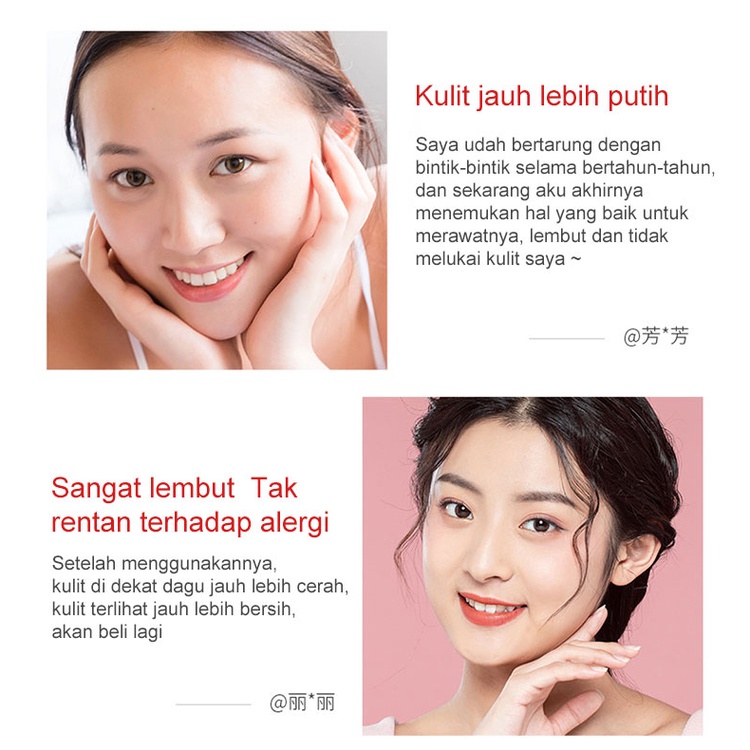 Dark Spot Serum Brightening Serum SPOT TREATMENT ACNE SPOT Krim PencerahMenghilangkan Melasma 20g Pemutih Efektif Penghilang Bintik hitam Diwajah