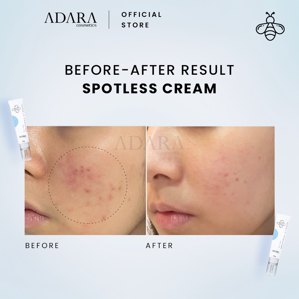 Adara Bee White Spotless Gel | Cream 20g