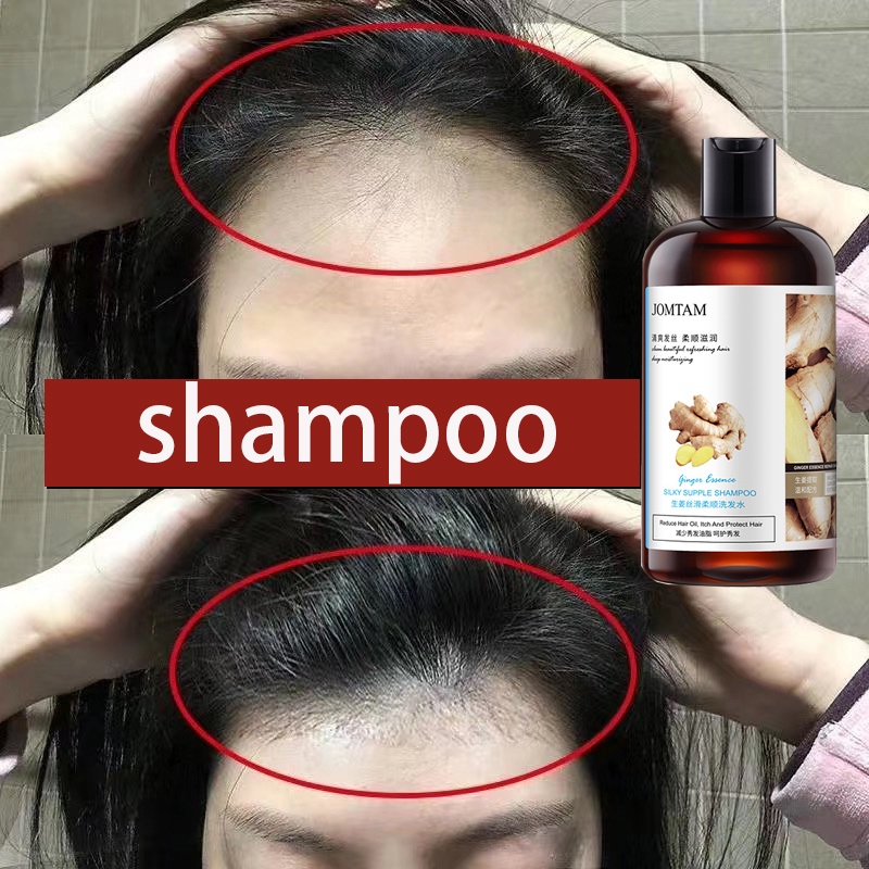 Shampoo Shampo Penumbuh Rambut Sampo 400ML Penumbuh Rambut Jahe Anti Rontok Rambut Sampo Anti Ketombe Dan Rontok