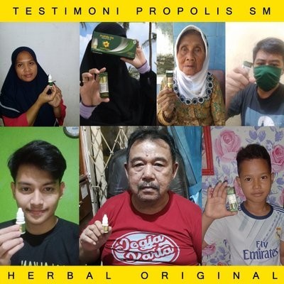 TERLARIS- Obat Pembersih Karang Gigi, Pemutih Gigi Kuning & Hitam (NEW)