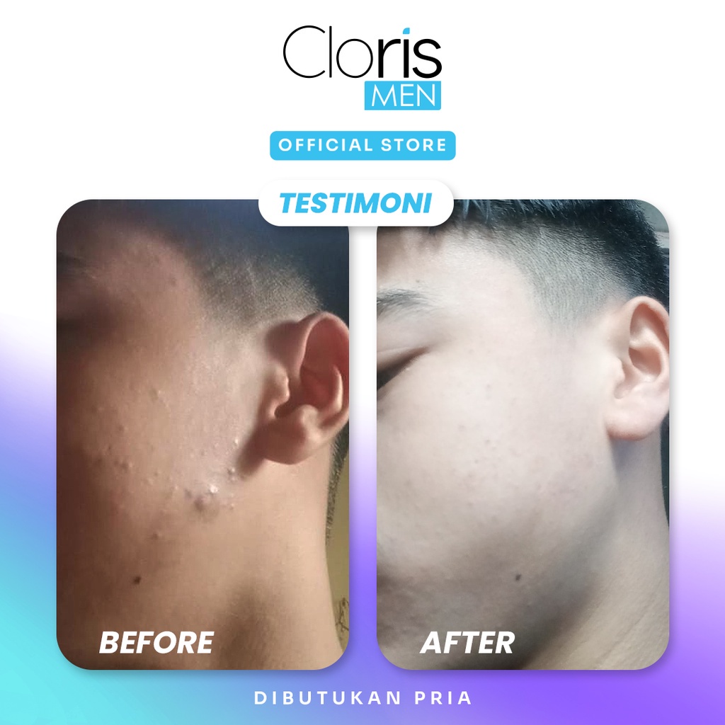 Clorismen SC SERUM Skincare Wajah Pria Penghilang Bekas Jerawat Bopeng Pria Bpom Original