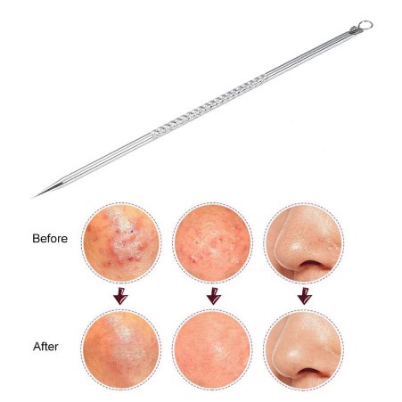 [GROSIR] PINSET ALAT PENCETAN KOMEDO JERAWAT 2 IN 1 FACIAL BLACKHEAD REMOVED