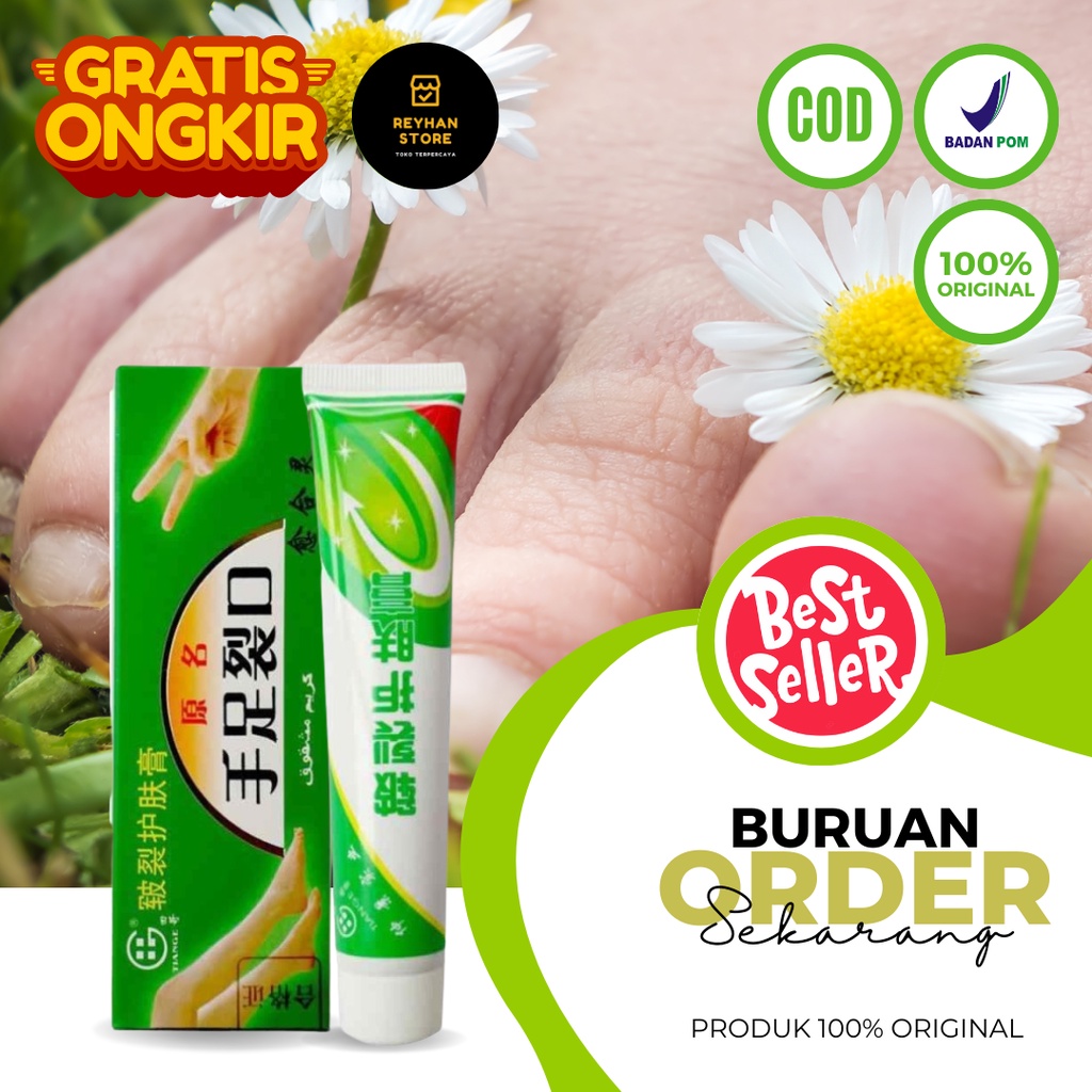 Obat Kaki Rayapan Dan Bau Salep Cina Obat Gatal Krim Pengelupas Kulit Mati Kaki Pembersih Kulit Mati
