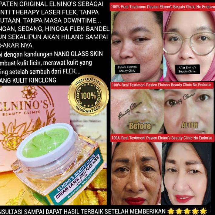 ♠ ELNINO'S CREAM LASER ANTI FLEK NANO GLASS SKIN 125% BEAUTY CLINIC ✩