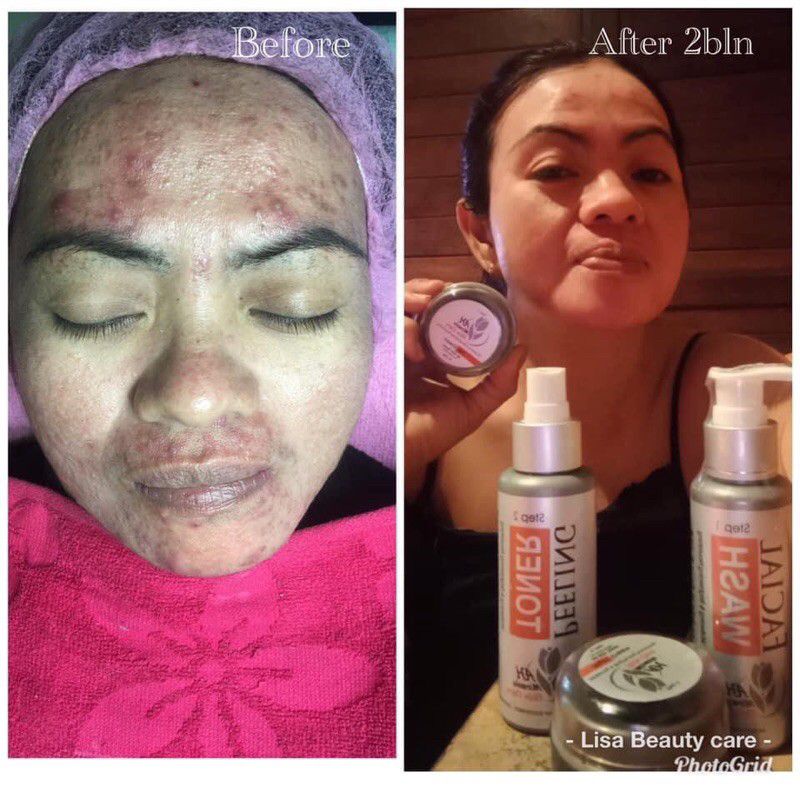 AH MIRACLE SKIN CARE