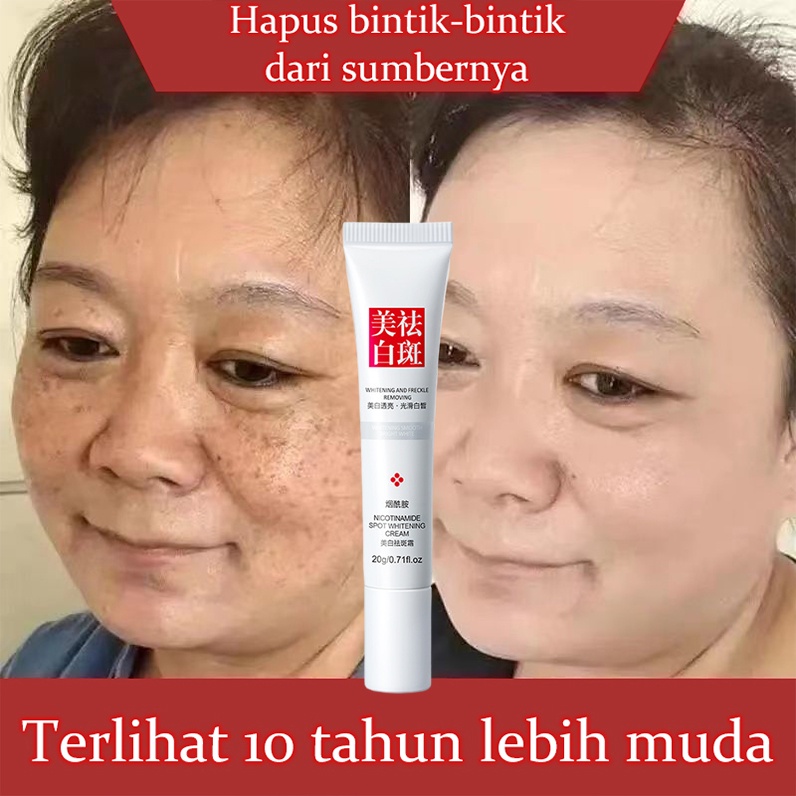 Cream penghilang flek hitam Krim pemutih wajah Krim bintik pemutih Krim penghilang flek 30G Remove Dark Spots Anti Freckle Cream Niacinamide Fade Pigmentation Melasma Brighten Creams concealer focallure