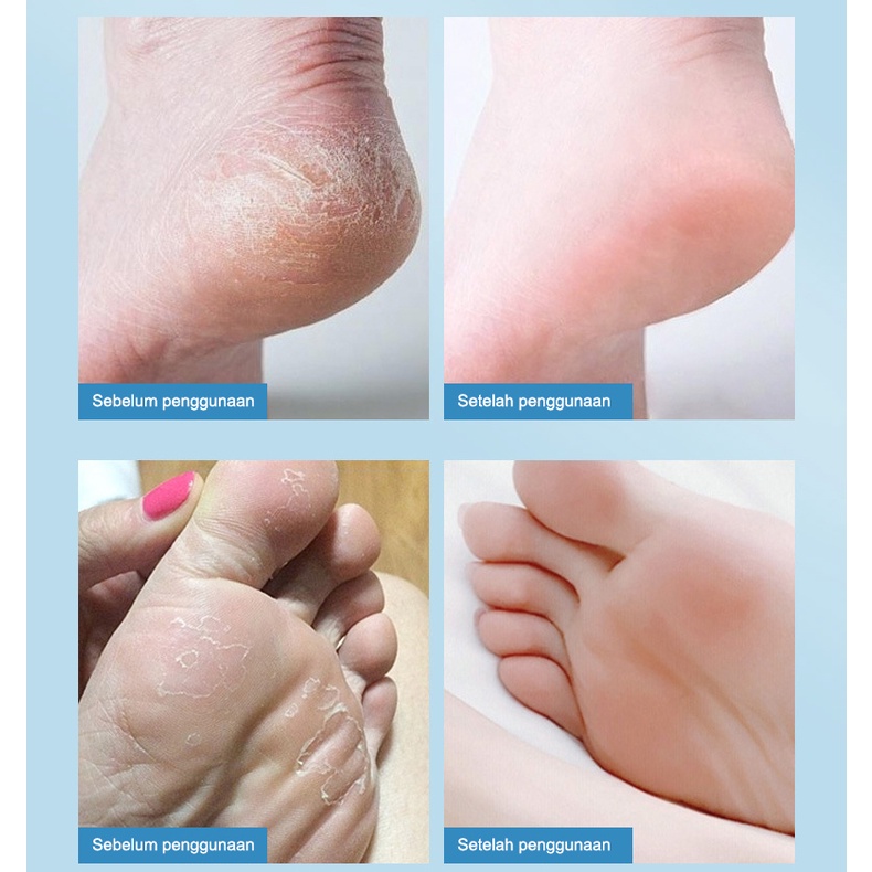 Obat Kaki Pecah Dan Kering Foot Cream Cream Krim Masker Penghilang Kaki Pecah Dan Kering 50g / cream untuk kulit kaki pecah-pecah /Perawatan Kaki Penghalus Tumit