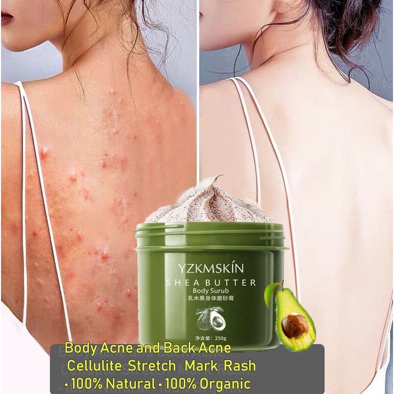 【HOT】YZKMSKIN Body Scrub-Lulur Tubuh Pemutih Badan Exfoliating Permanen 250Gr/Menghilangkan Kulit Ayam, Kulit Mati/Membersihkan Secara Dalam, Mencerahkan Warna Kulit