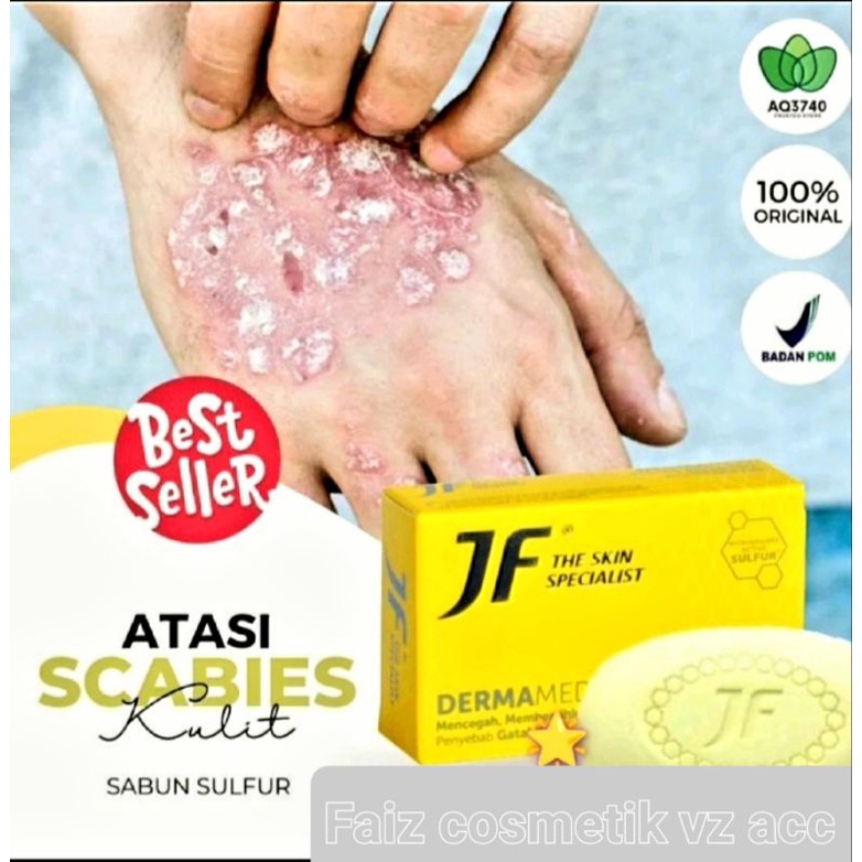 JF SULFUR SABUN MUKA / JF Sulfur Anti Acne Sabun Wajah[ Ada Varian Yg Buat Gatal,jamur,Kurap, dan juga Kadas]